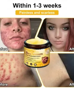 Cavebit® Bee Venom Skin Restoration Cream