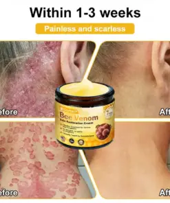 Cavebit® Bee Venom Skin Restoration Cream