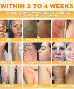 Cavebit® Bee Venom Skin Restoration Cream