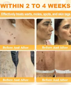 Cavebit® Bee Venom Skin Restoration Cream