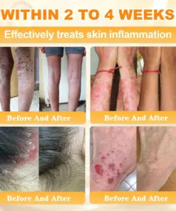 Cavebit® Bee Venom Skin Restoration Cream