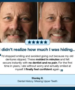Cavebit™ Medical Full Denture with Strong Suctiond