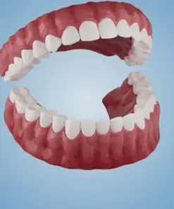 Cavebit™ Medical Full Denture with Strong Suctiond