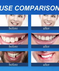 Cavebit™ Medical Full Denture with Strong Suctiond