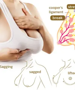 Cavebit Breast Boost & Firm Micro‑Needle Patches