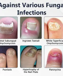 Cavebit® NailFungiClear Pro Antifungal Pen
