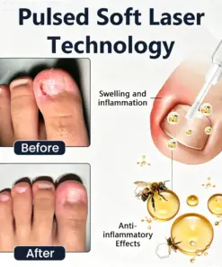 Cavebit® NailFungiClear Pro Antifungal Pen